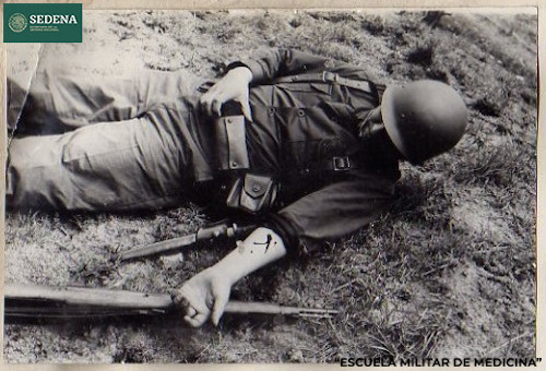 Imagen de Soldado en campo abierto con herida de bala en el antebrazo (atribuido)