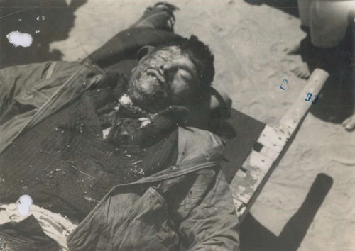 Imagen de El cuerpo de Patricio Tovar sobre una camilla (atribuido)