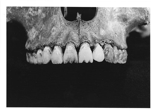 Imagen de Dentadura de cráneo (atribuido)